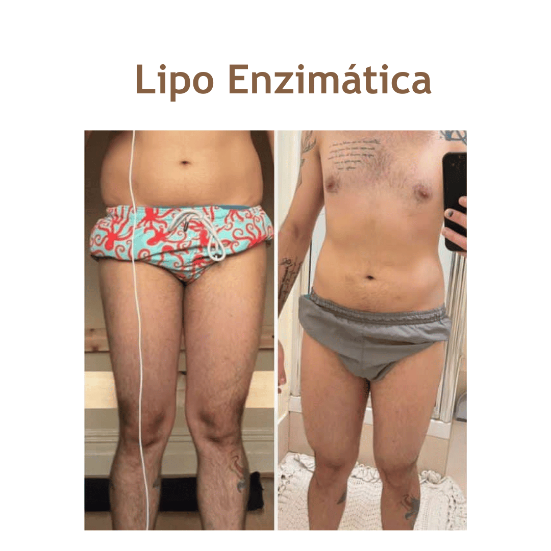 Lipoenzimaticasite