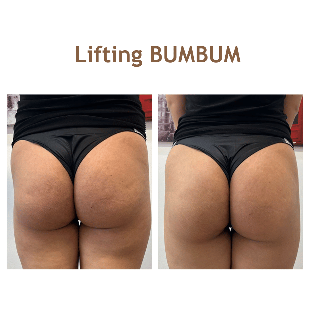 liftingbumbum