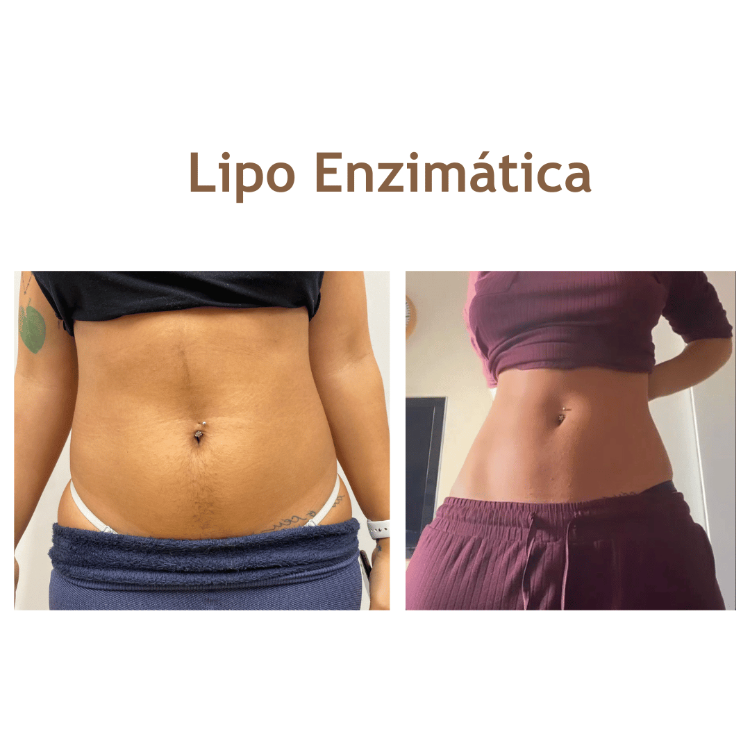 lipoenzimatica-siute